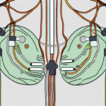 A tens unit with its electrodes attached to the neck area